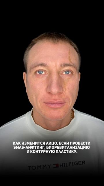 -5255468888645937852