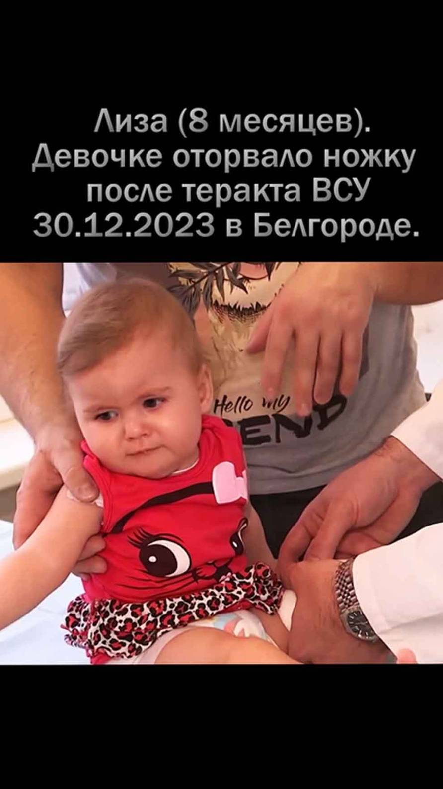 Девочке оторвало ножку после теракта ВСУ.