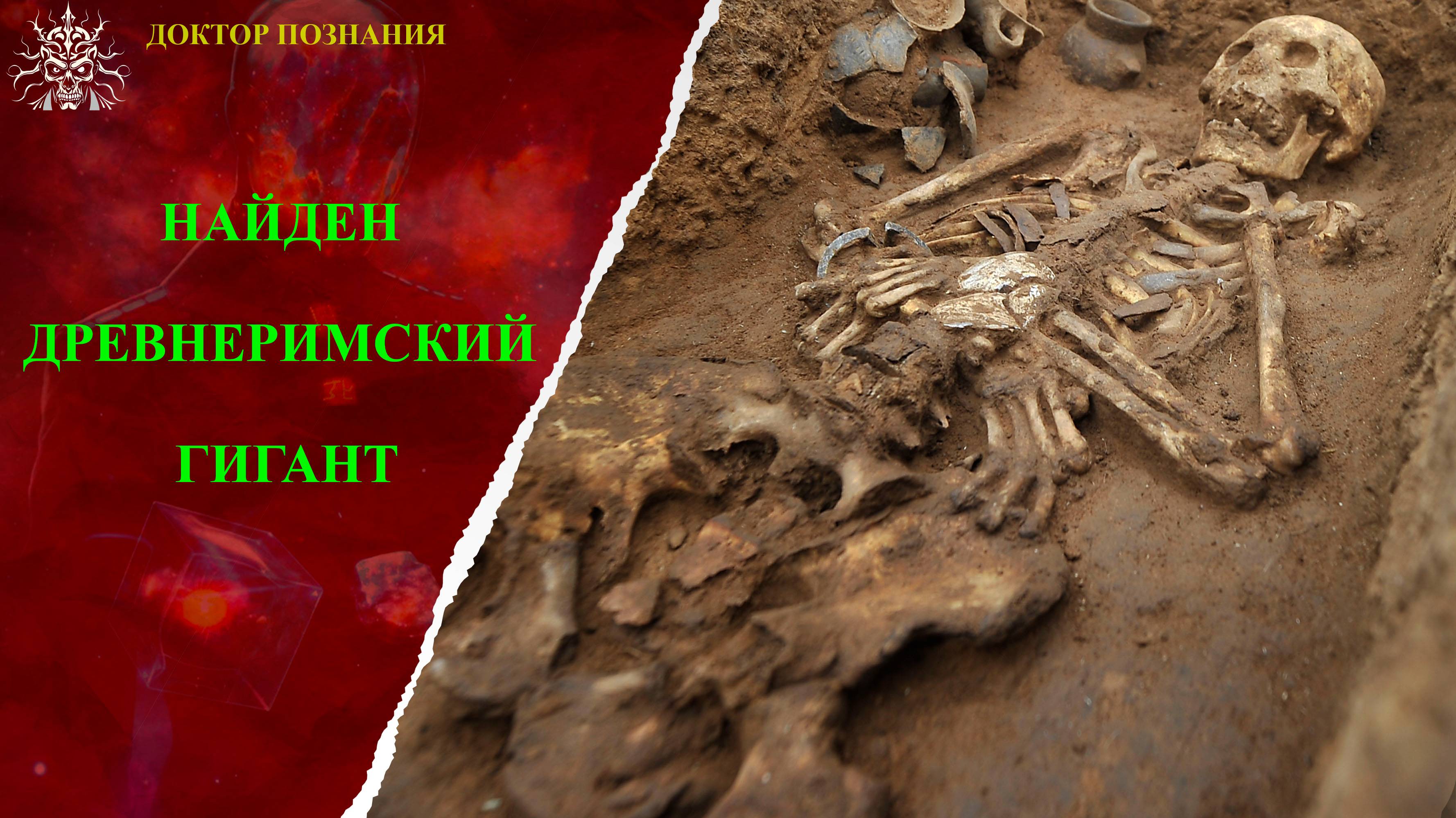 Древний великан: загадка гигантизма в античности.