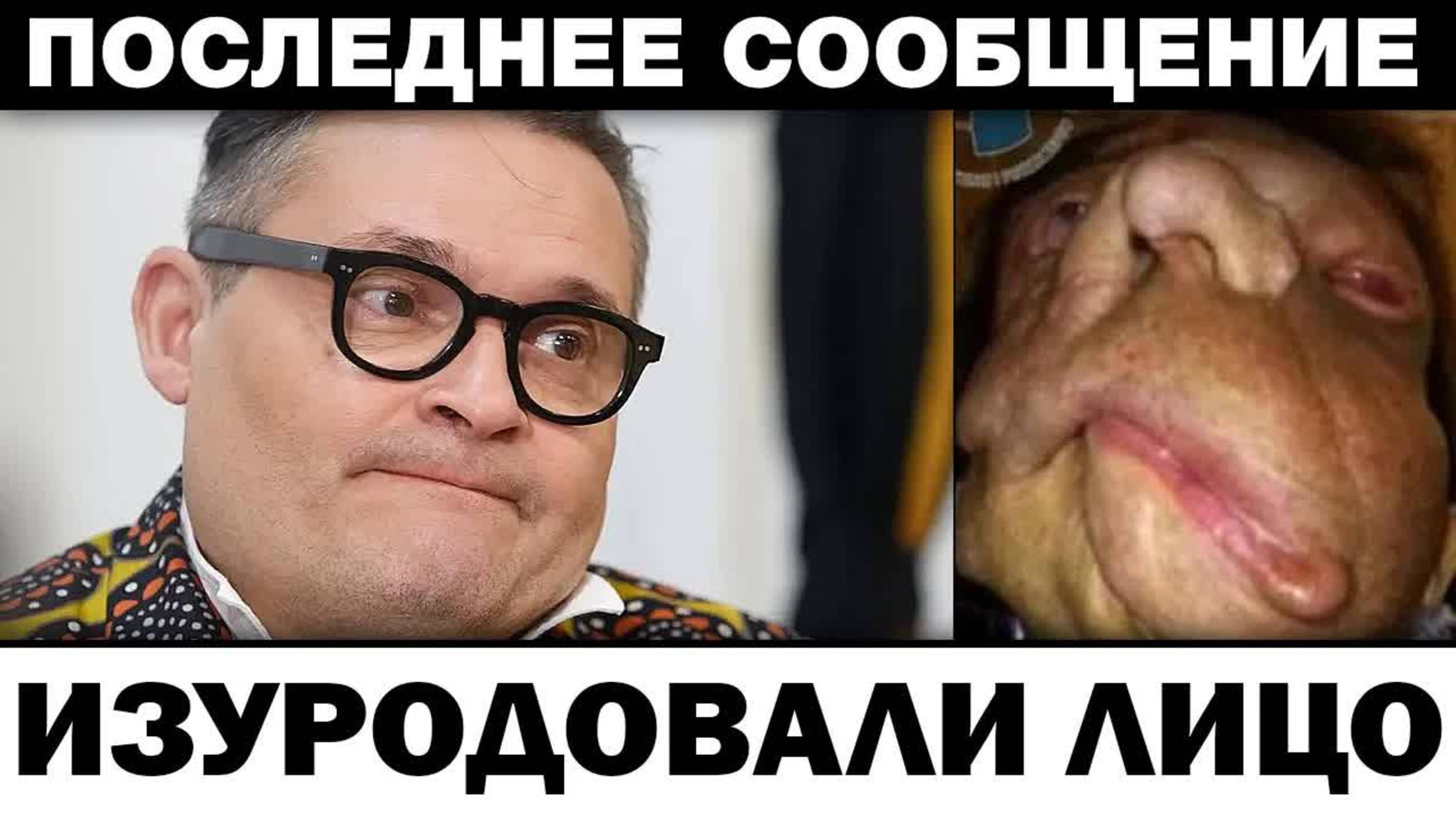 Изypoдовали лицо. Александр Васильев yдap откуда не ждал, новости шоубизнеса