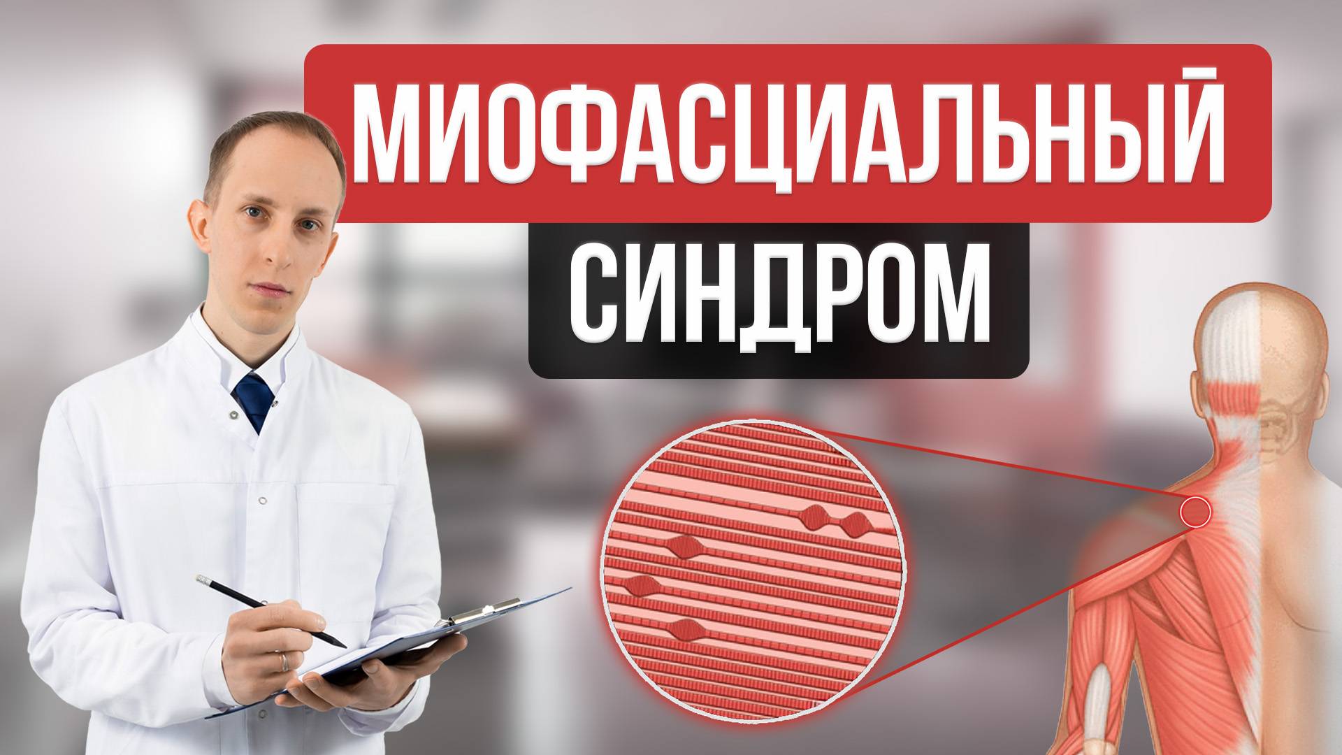 Миофасциальный болевой синдром и фибромиалгия
