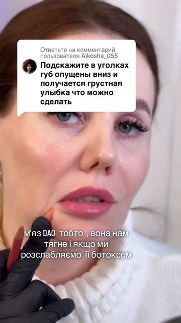 Опущение уголков губ #косметолог #догляд #косметологи?