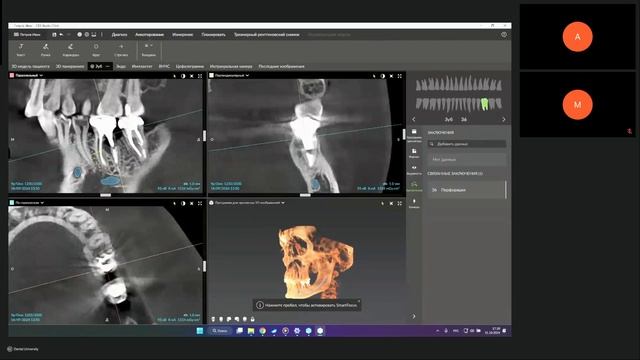 Оптимизация рабочего времени врача ПО DTX Studio Clinic с инт?