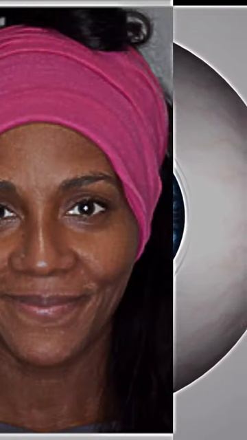 Change your eyecolor #eyecolor #health #aesthetic #beauty #looksmaxxing #gym #gymtok #transformation