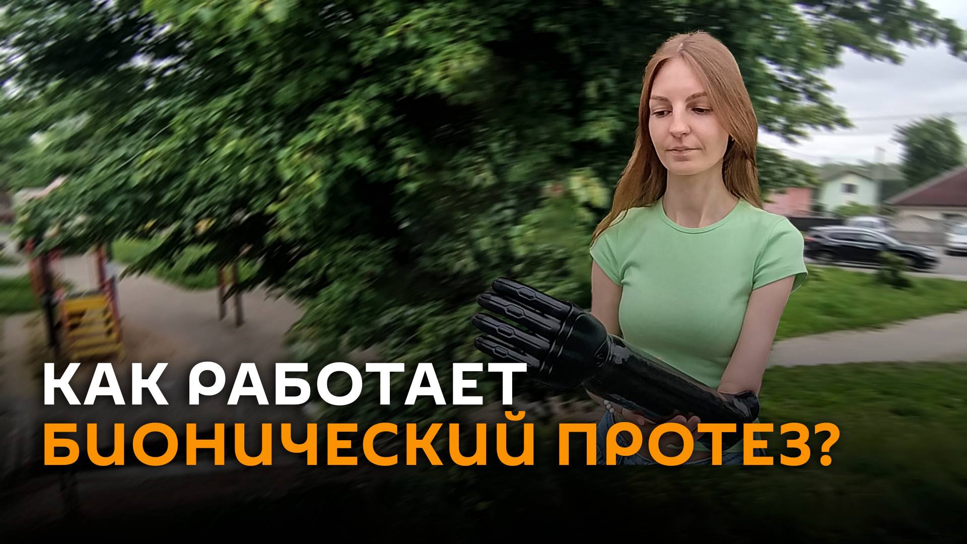 Как работает бионический протез?