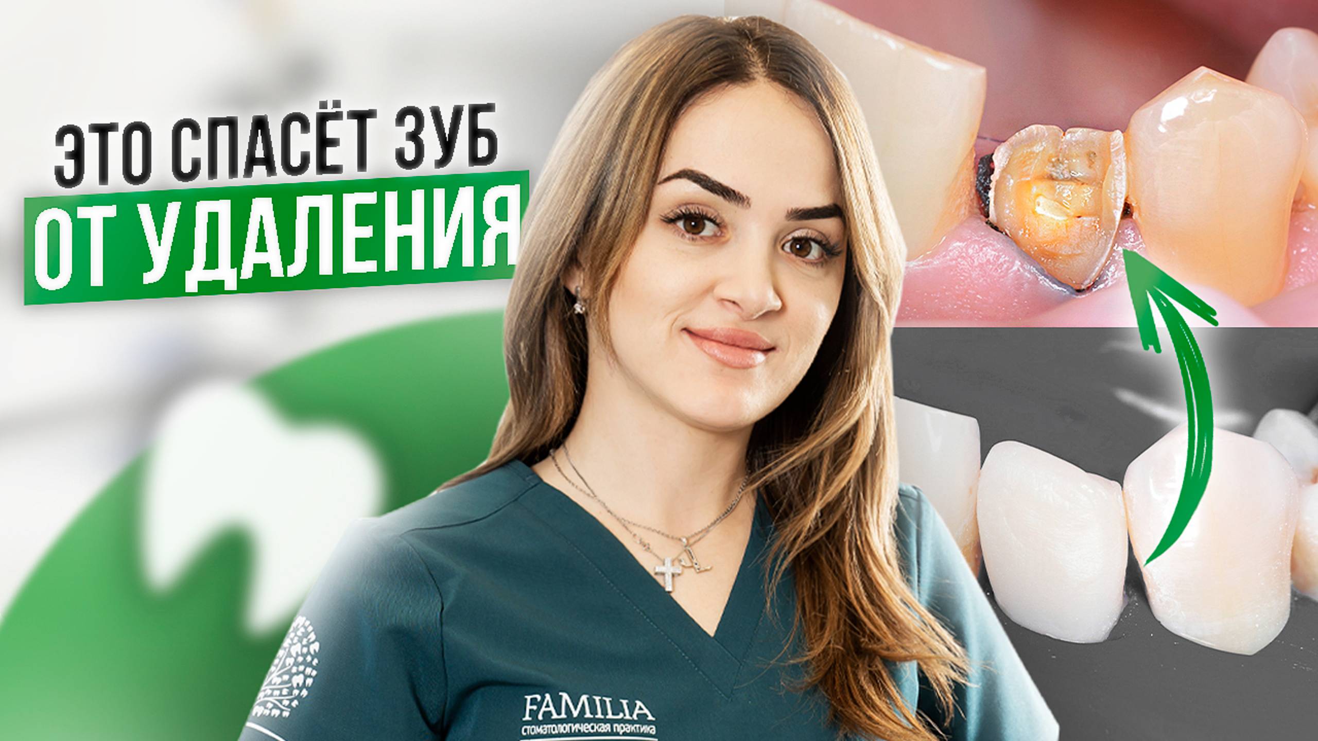 Как не лишиться зуба навсегда после лечения у стоматолога?