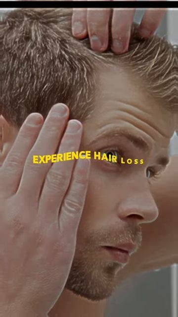 Balding may NOT be genetic!