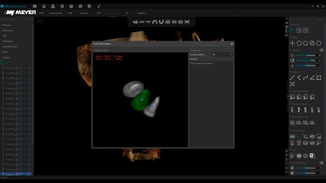 Отчет об автоматическом измерении цефалгии в ортодонтии MEC ‑3D MEYER