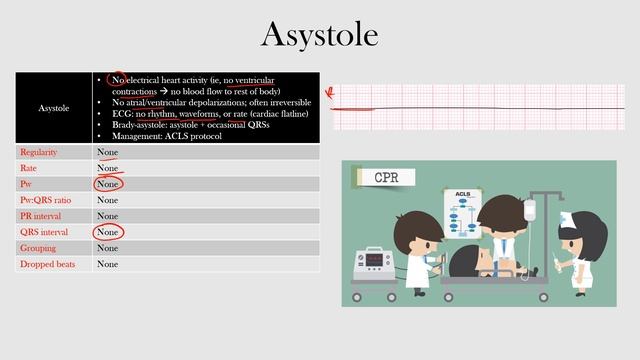 64.Asystole