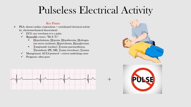 65.Pulseless Electrical Activity