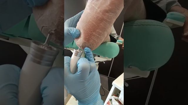 1000005563.mp4