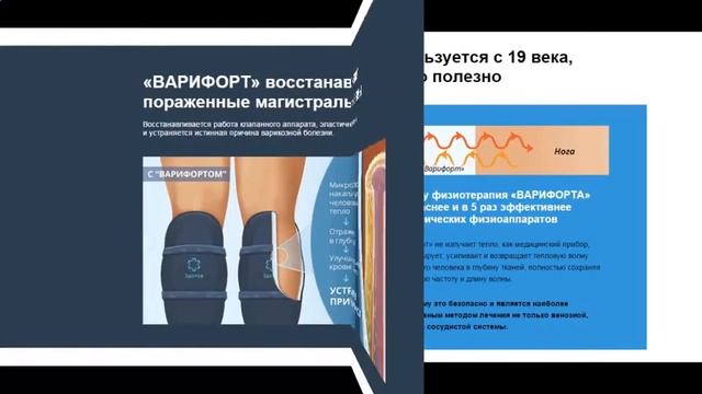Купить варифорт от варикоза!