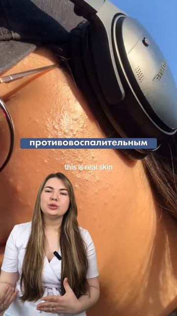 закрытые комедоны