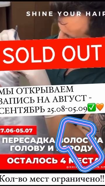 Открыта запись на пересадку волос в спб и Стамбуле #пе?