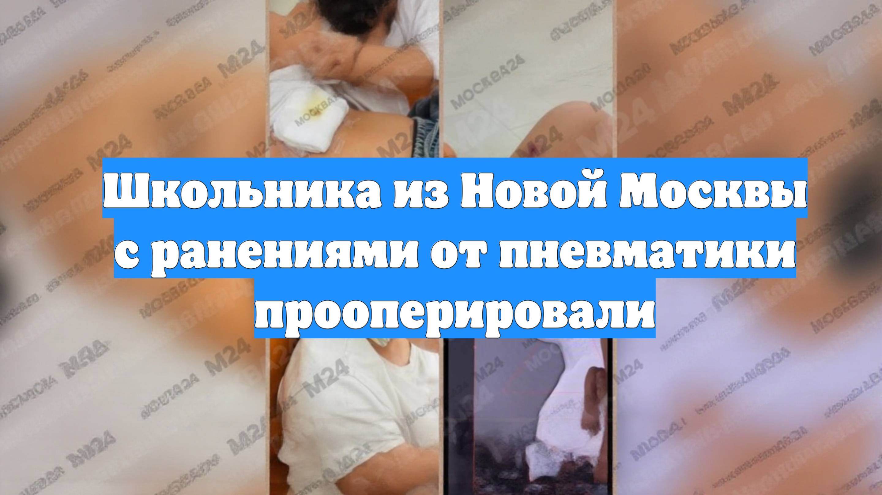 Школьника из Новой Москвы с ранениями от пневматики прооперировали