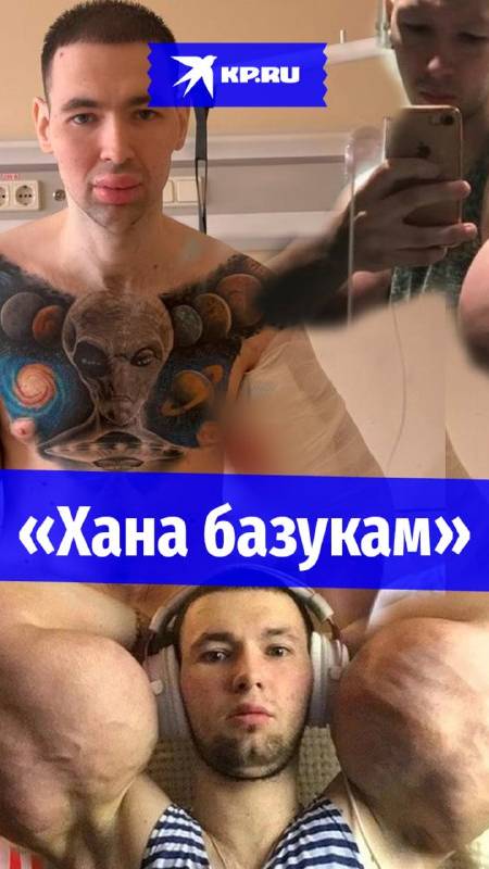 Кирилл «Руки-базуки» решился на операцию