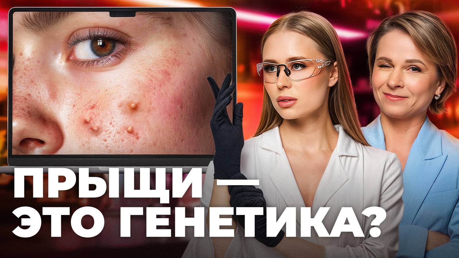 Причины акне, о которых не говорят. Что поможет убрать высыпания?