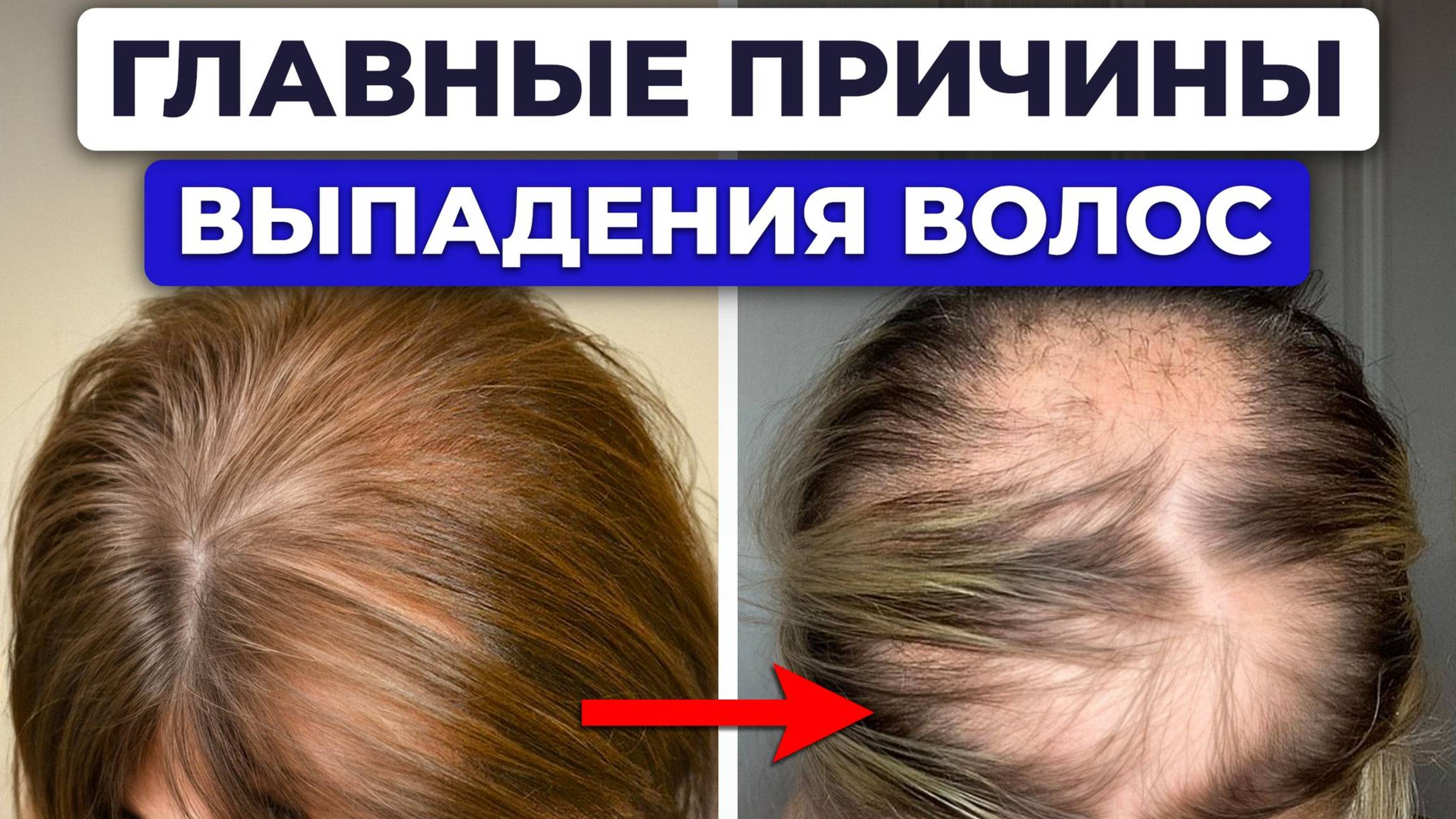 КАК бороться с выпадением волос? / ГЛАВНЫЙ китайский секрет хороших волос