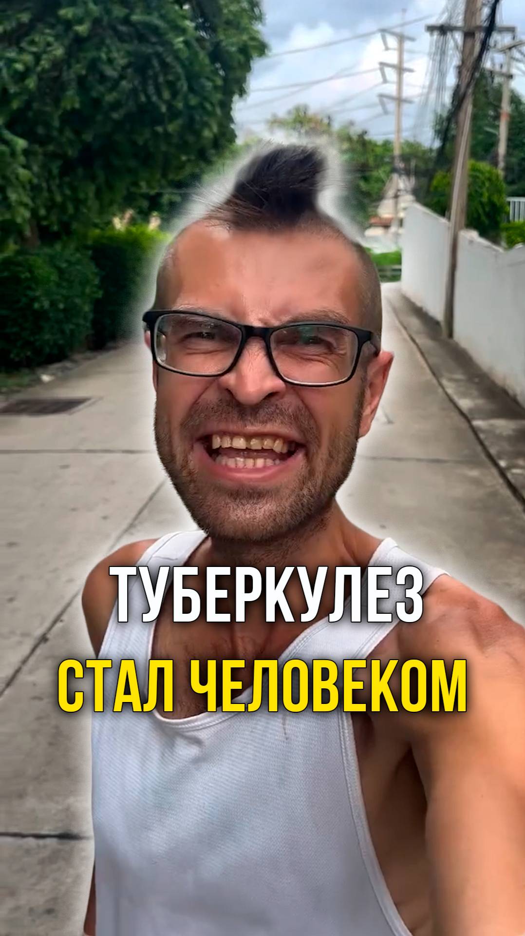 Туберкулез стал человеком