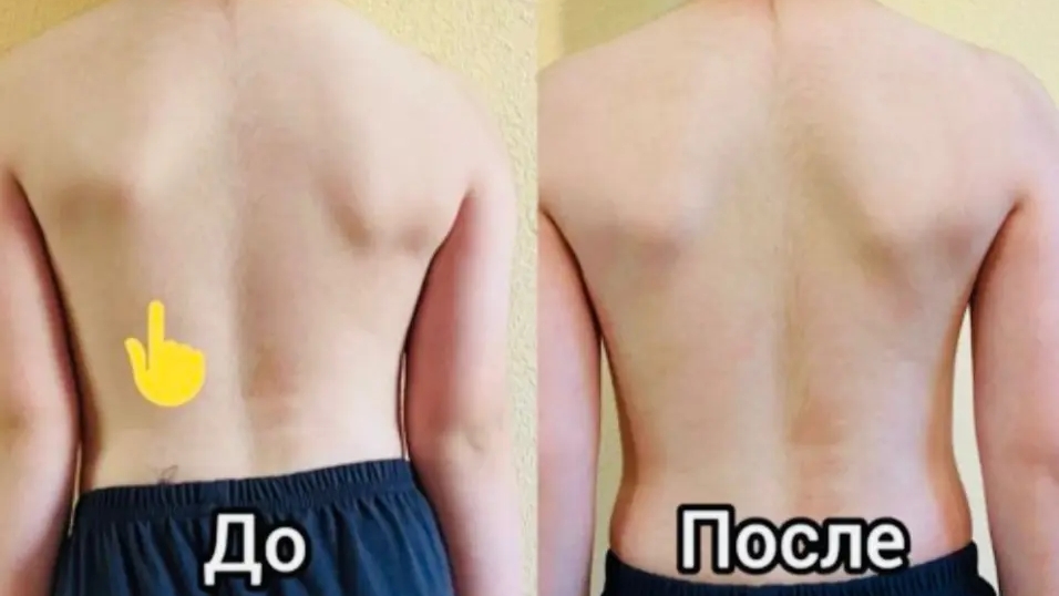 Строение позвоночника