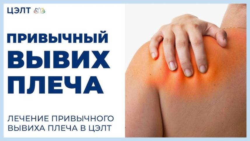 🙋 Привычный вывих плеча. Лечение привычного вывиха плеча в ЦЭЛТ.