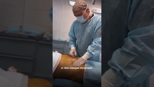 Плоский живот после двух родов 🤰
