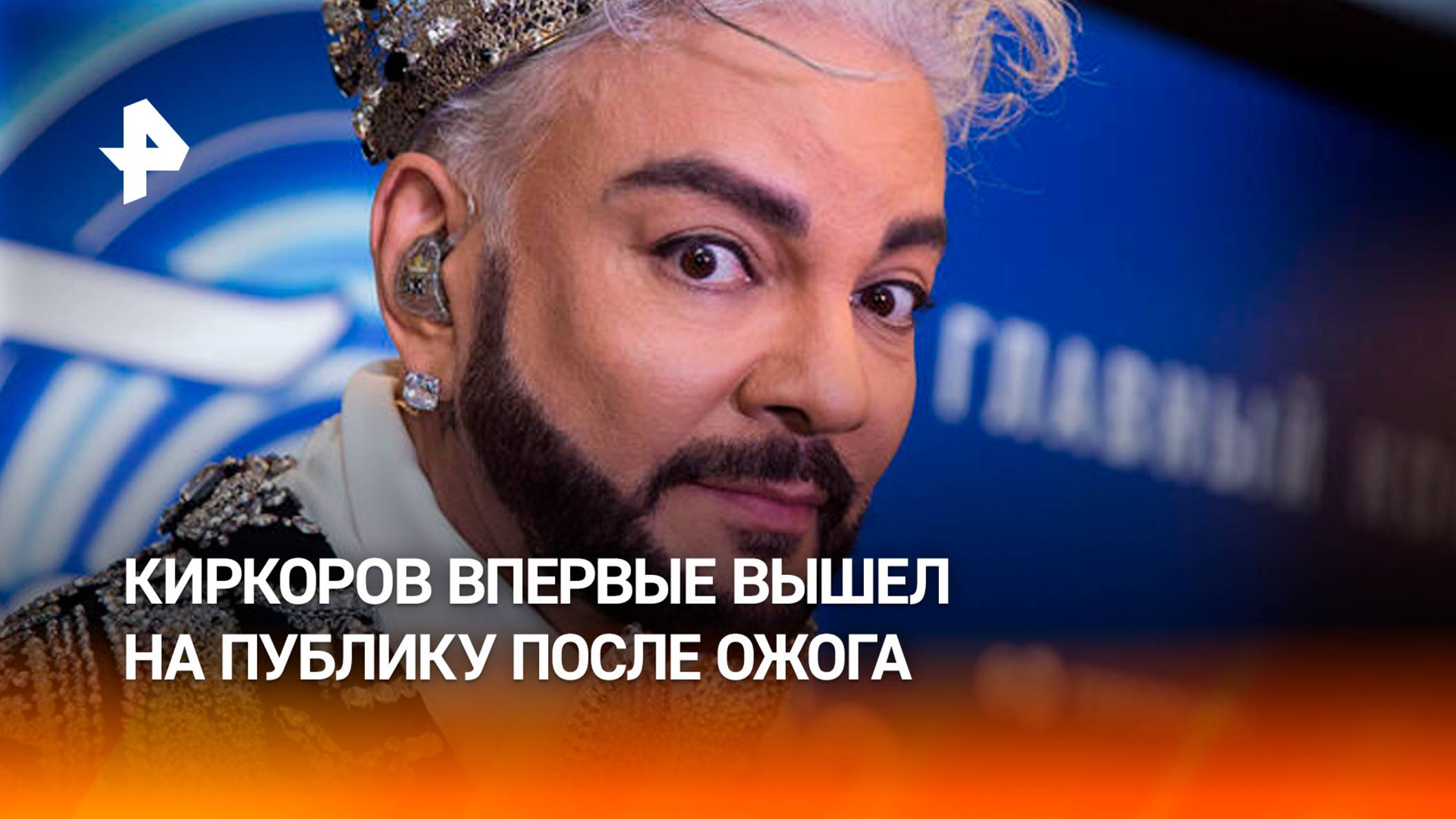 Филипп Киркоров на премии МУЗ-ТВ — артист впервые появился на публике после ожога на концерте