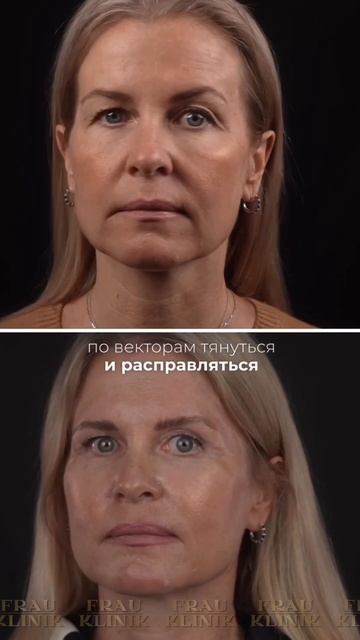 Преображение моей пациентки✨
