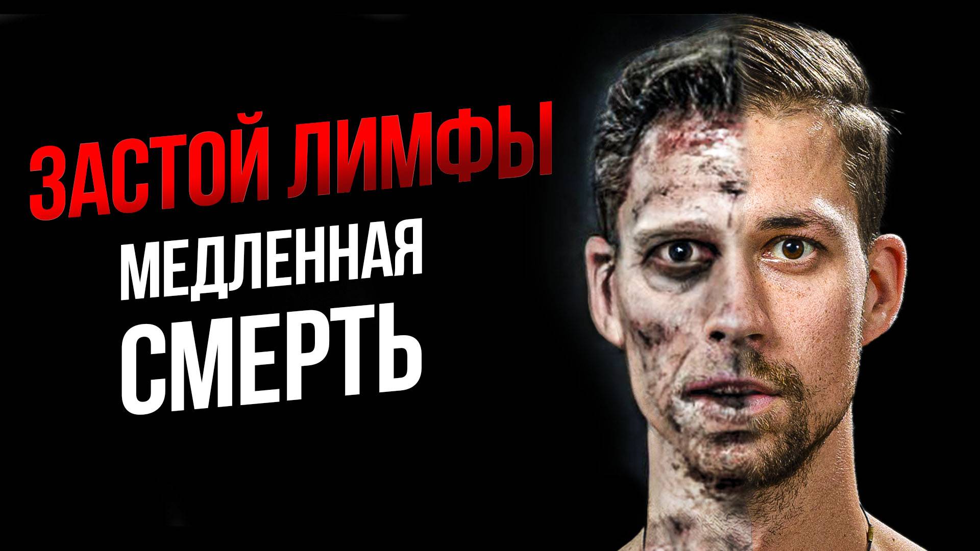 ВРАЧИ СКРЫВАЮТ! 7 ПРИЗНАКОВ, ЧТО ТВОЯ ЛИМФА — ГНИЮЩАЯ КАНАЛИЗАЦИЯ. КАК СПАСТИСЬ БЕЗ ЛЕКАРСТВ.