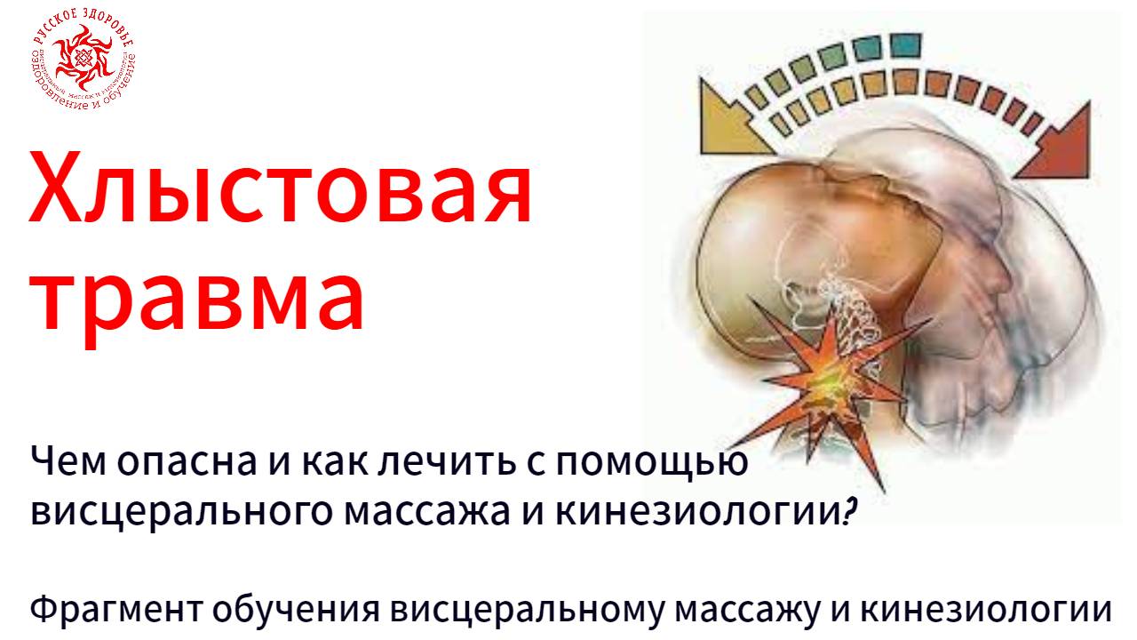 Хлыстовая травма. Чем опасна и как лечить с помощью висцерального массажа и кинезиологии?