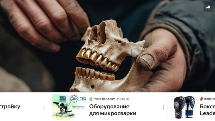 Паразиты и боль без наркоза: кровавая история удаления зубов