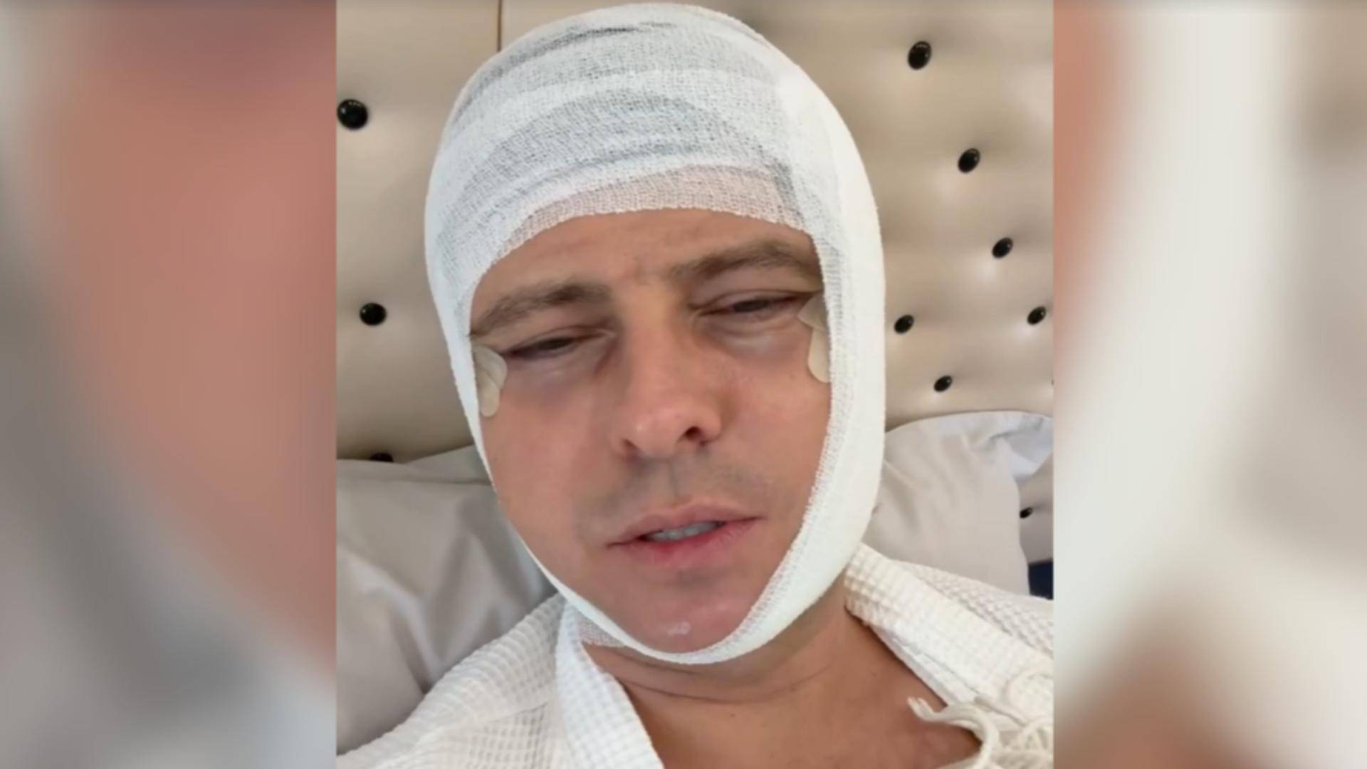 «На десять лет моложе»: Прохор Шаляпин показал лицо после пластики