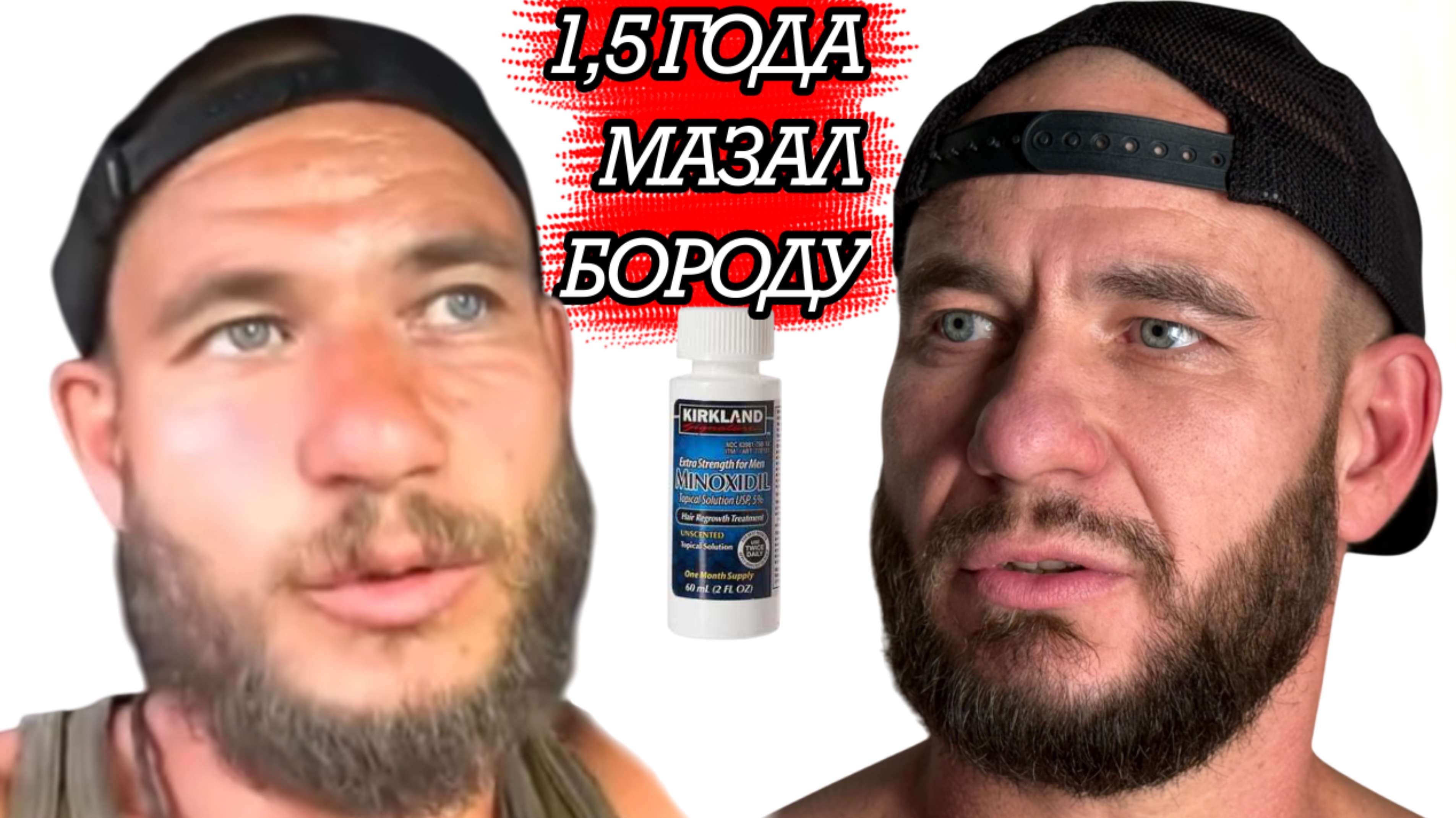 1,5 ГОДА МАЗАЛ БОРОДУ | ВОТ ЧТО ВЫШЛО