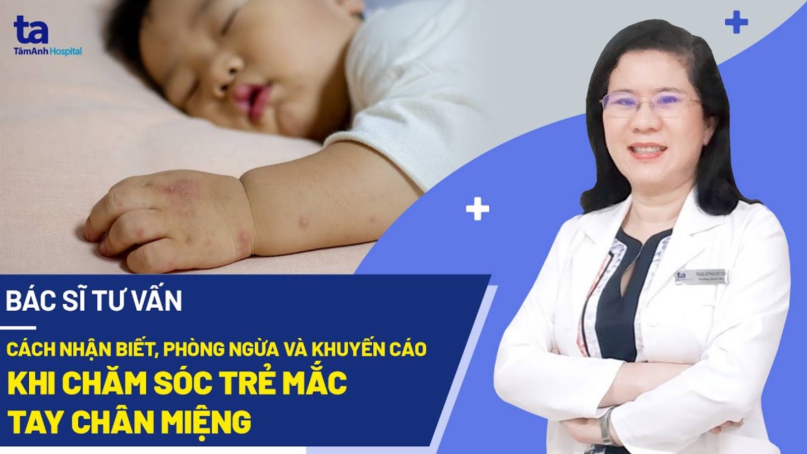 Bệnh tay chân miệng ở trẻ em: Nguyên nhân, biểu hiệu và cách điều trị hiệu quả | BVĐK Tâm Anh