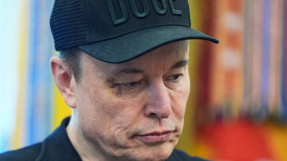 WP: глава Минфина США Бессент поставил Маску фингал под глазом