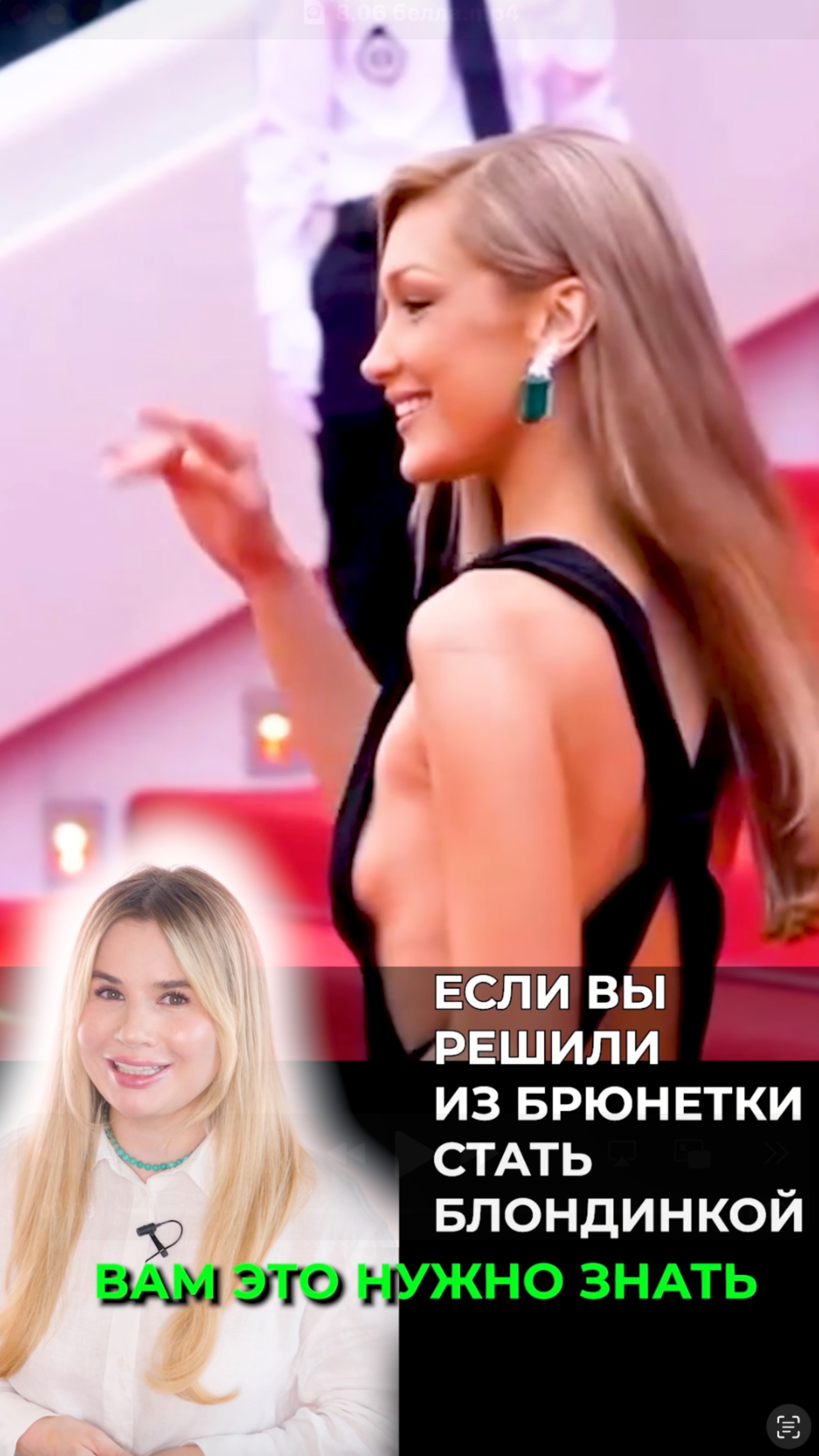 Уверена, что все видели преображение Беллы Хадид. К каким проблемам может привести такое изменение