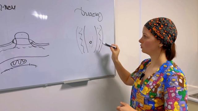 Грыжа vs диастаз — не путайте! Объясняет руководитель герниоцентра Елена Студенова, врач-хирург
