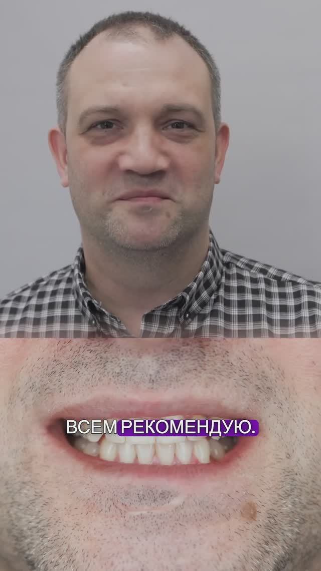 Видео-отзыв от пациента