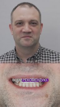 Видео-отзыв от пациента