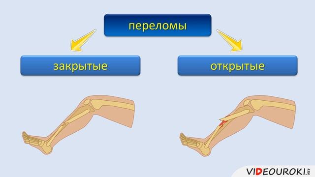 Первая_помощь_при_ушибах,_растяжениях,_вывихах_и_переломах