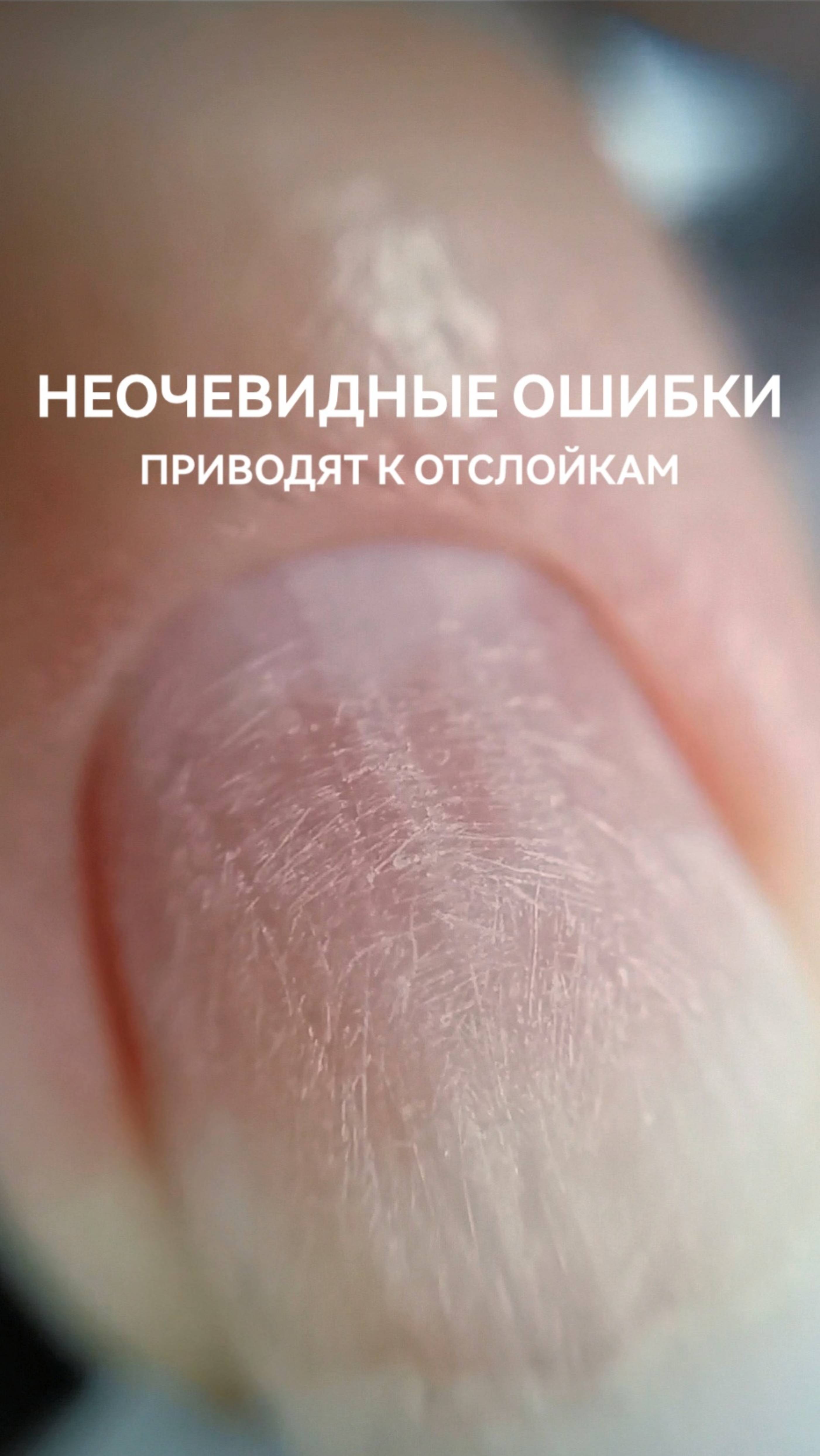 Неочевидные ошибки, которые приводят к отслойкам геля.