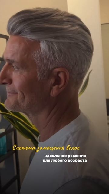 Система волос