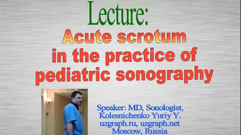 Acute scrotum in a child sonography