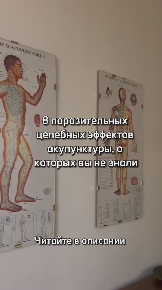 8 поразительных целебных эффектов акупунктуры, о которых вы не знали