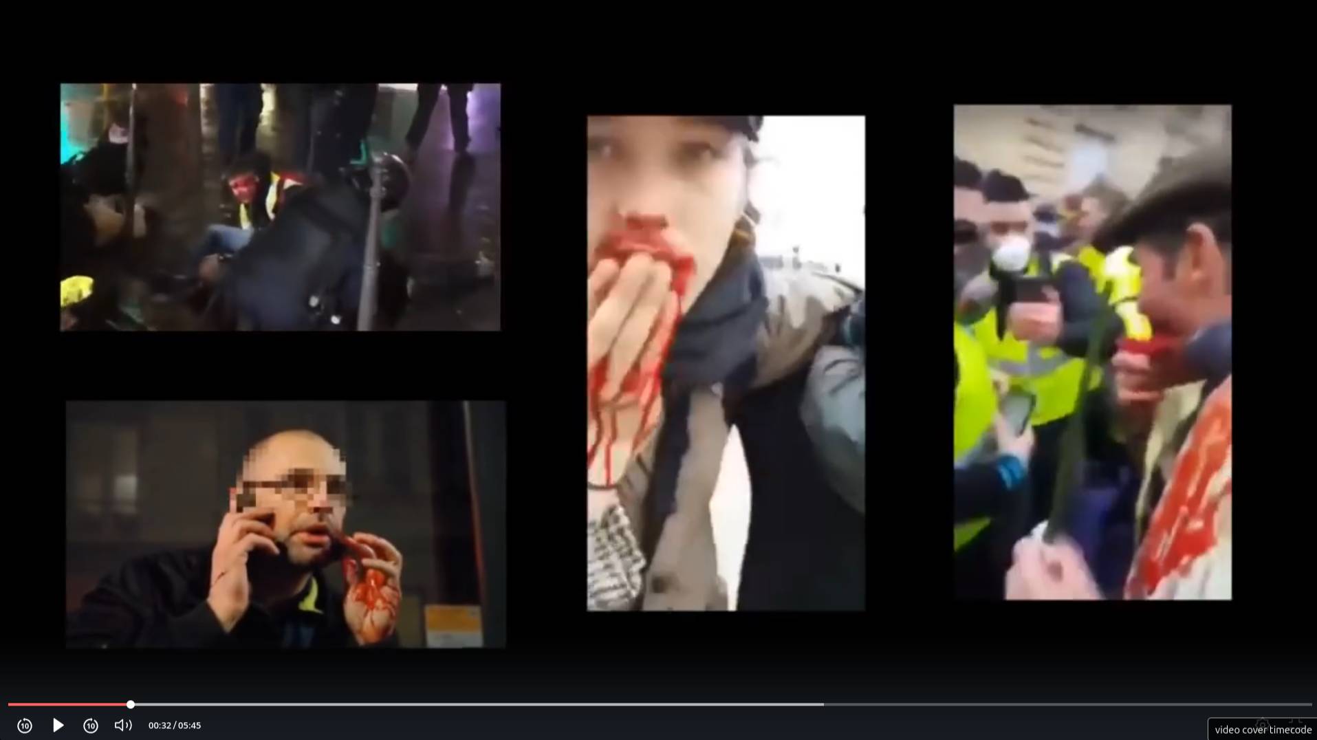 JACCUSE - STOP Violences policières _ Blessés Gilets Jaunes
