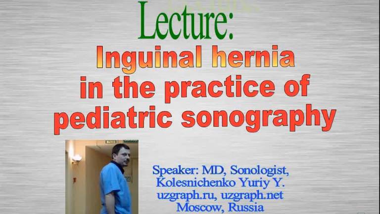 Inguinal hernia in a child sonography