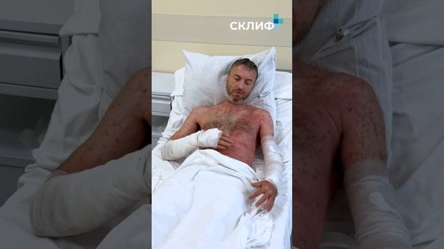 Грядки смерти открыты первая жертва борщевика в этом сезоне — ожоги по всему телу, пострадало 80% ко