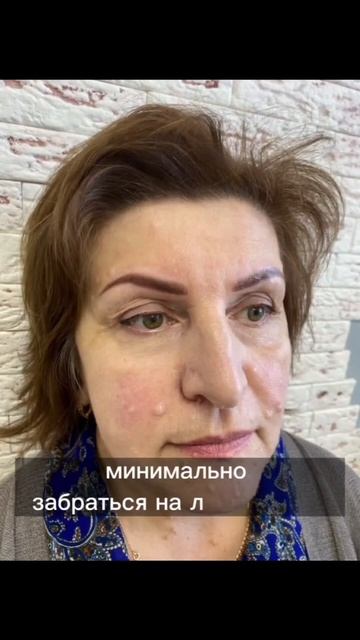 Сложный случай
