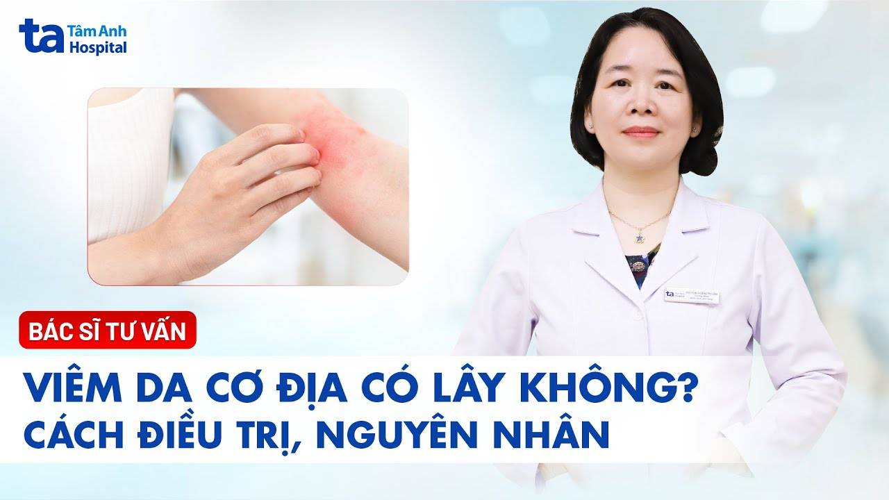 Nguyên nhân và triệu chứng của viêm da cơ địa | Bệnh viện Đa khoa Tâm Anh