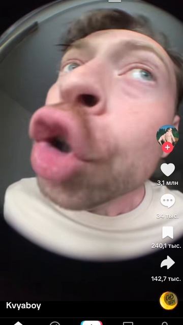 шиза